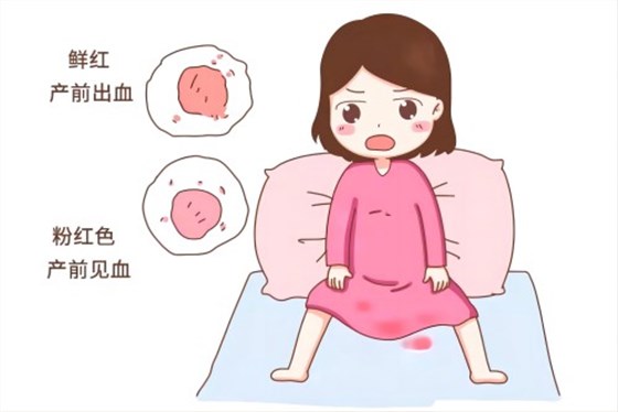 产后出血